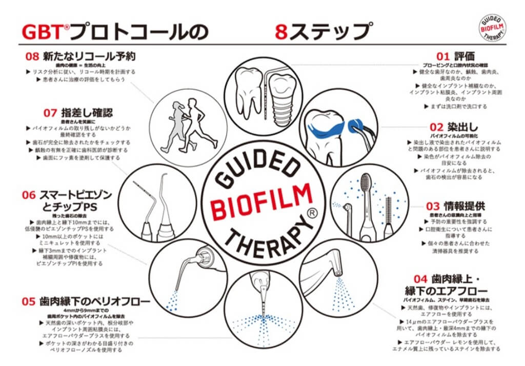 GBT®プロトコールの8ステップを示した図。